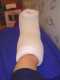Le gros bandage de Debbie